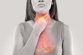 Acidesa-Reflux